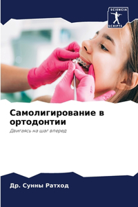 Самолигирование в ортодонтии