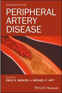 Peripheral Artery Disease