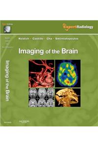 Imaging of the Brain: Expert Radiology Series