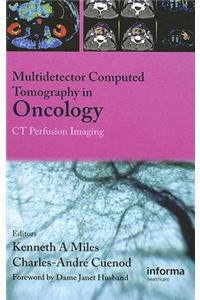 Multi-Detector Computed Tomography in Oncology