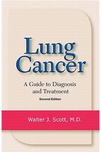 Lung Cancer: A Guide to Diagnosis and Treatment