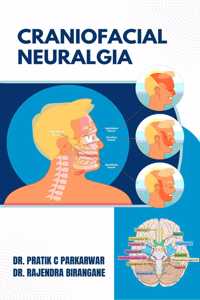 Craniofacial Neuralgia