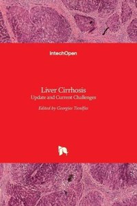 Liver Cirrhosis