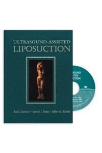 Ultrasound-Assisted Liposuction