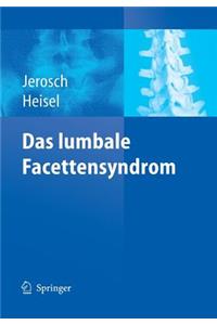 Das Lumbale Facettensyndrom