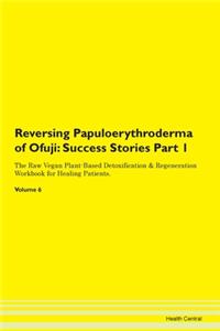 Reversing Papuloerythroderma of Ofuji: S