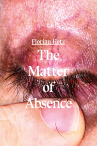 The Matter of Absence
