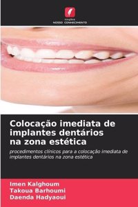 Colocação imediata de implantes dentários na zona estética