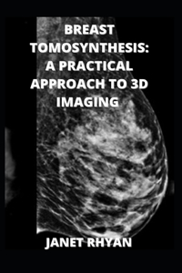 Breast Tomosynthesis