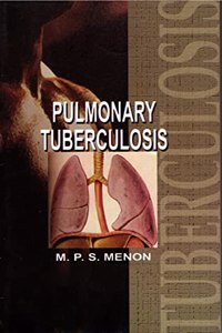 Pulmonary Tuberculosis
