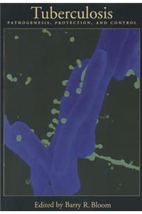 Tuberculosis