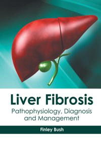 Liver Fibrosis: Pathophysiology, Diagnosis and Management