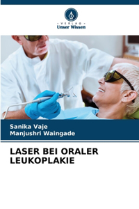 Laser Bei Oraler Leukoplakie