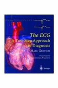 The ECG: A Two-Step Approach to Diagnosis