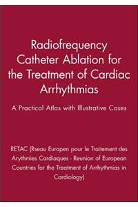 Radiofrequency Catheter Ablation for the Treatment of Cardiac Arrhythmias