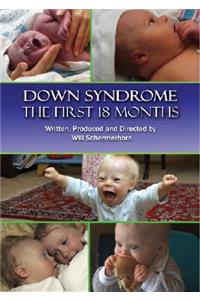 Down Syndrome: The First 18 Months: The First 18 Months