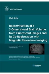 Reconstruction of a 3-Dimensional Brain Volume from Fluorescent Images and its Co-Registration with Magnetic Resonance Imaging