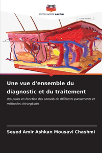 vue d'ensemble du diagnostic et du traitement