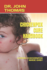 Chickenpox Cure Handbook