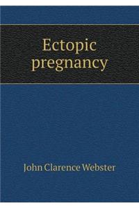 Ectopic Pregnancy