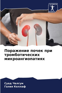 Поражение почек при тромботических микро
