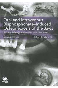 Oral and Intravenous Bisphosphonate-Induced Osteonecrosis of the Jaws: History, Etiology, Prevention, and Treatment