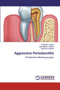 Aggressive Periodontitis