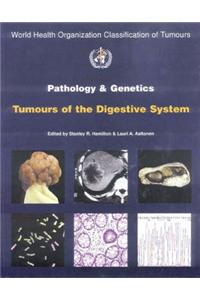 Pathology and Genetics of Tumours of the Digestive System