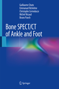 Bone Spect/CT of Ankle and Foot