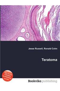 Teratoma