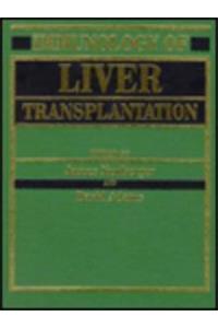 Immunology of Liver Transplantation (Hodder Arnold Publication)