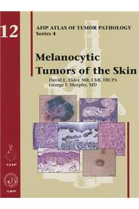 Melanocytic Tumors of the Skin