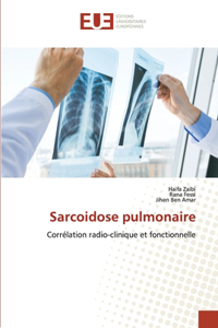 Sarcoidose pulmonaire