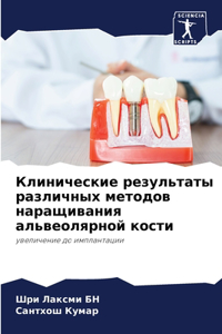 Клинические результаты различных методо&