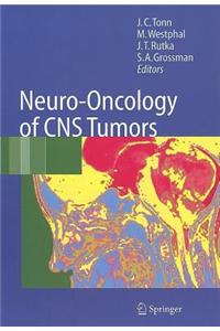 Neuro-Oncology of CNS Tumors