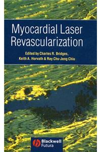 Myocardial Laser Revascularization