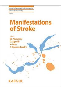 Manifestations of Stroke