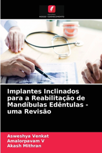 Implantes Inclinados para a Reabilitação de Mandíbulas Edêntulas - uma Revisão