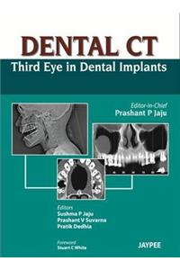 Dental CT Third Eye in Dental Implants