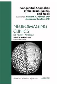 Congenital Anomalies of the Brain, Spine, and Neck, an Issue of Neuroimaging Clinics