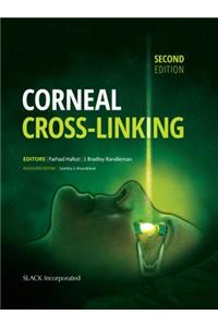 Corneal Cross-Linking