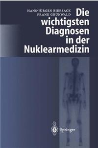 Die Wichtigsten Diagnosen in Der Nuklearmedizin