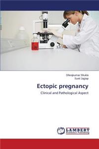 Ectopic pregnancy