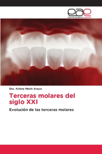 Terceras molares del siglo XXI