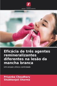 Eficácia de três agentes remineralizantes diferentes na lesão da mancha branca