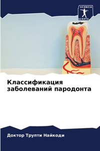 Классификация заболеваний пародонта