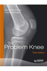 The Problem Knee