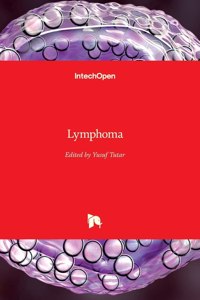 Lymphoma