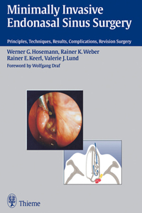 Minimally Invasive Endonasal Sinus Surgery