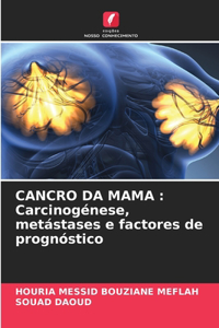 Cancro Da Mama